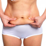 Which Tummy Tuck is Right for You?