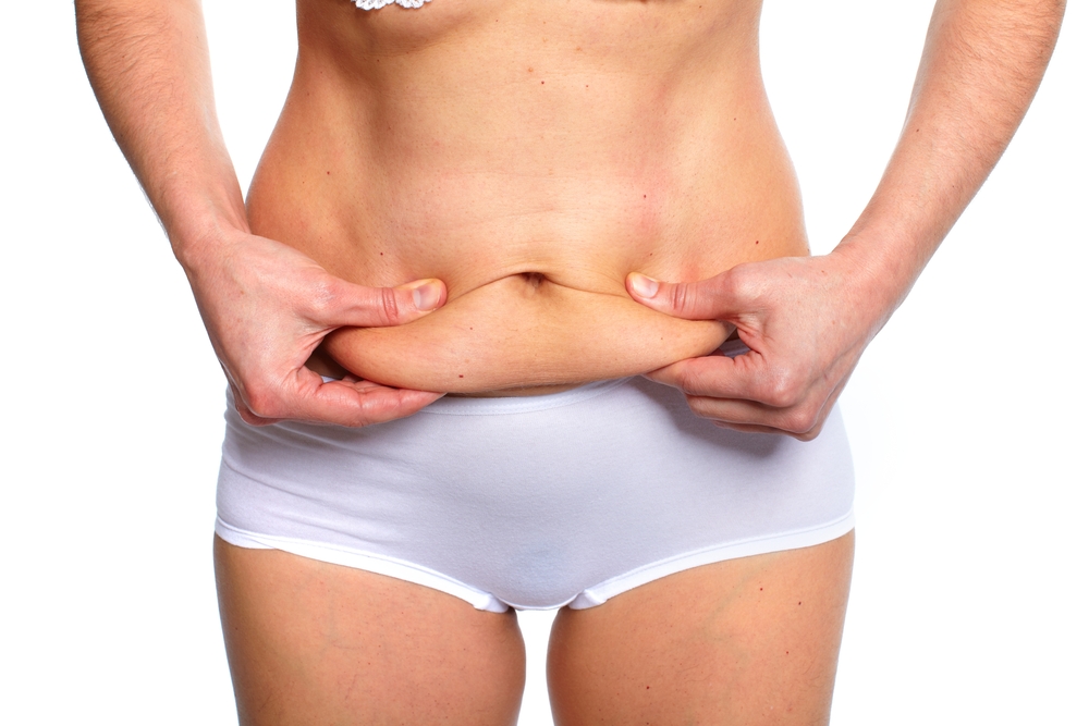 Which Tummy Tuck is Right for You?